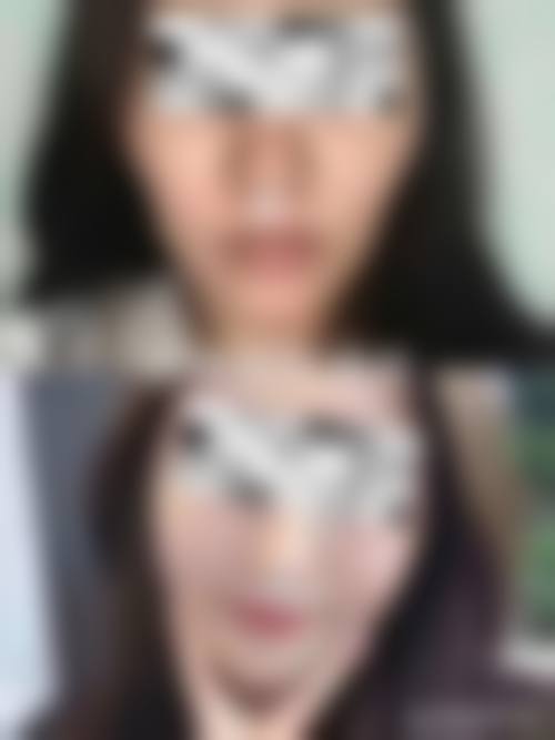 七、成都水晶唯罗纳医疗整形美容价格表：（仅供参考）