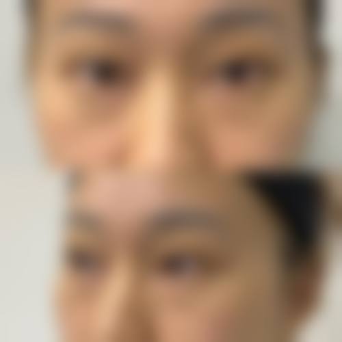 八、黄冈市中 心医院烧伤整形美容外科(考棚街院区)真实的顾客评价如下: