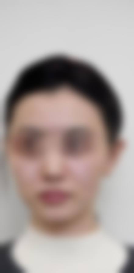 朴奉权医生怎么样可靠吗?
