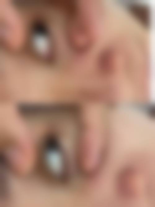 孙恺医生实例