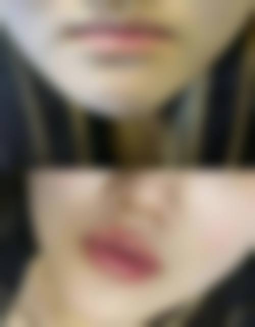 七、兰州军区陆 军总院整形美容中 心价格表:(仅供参考)