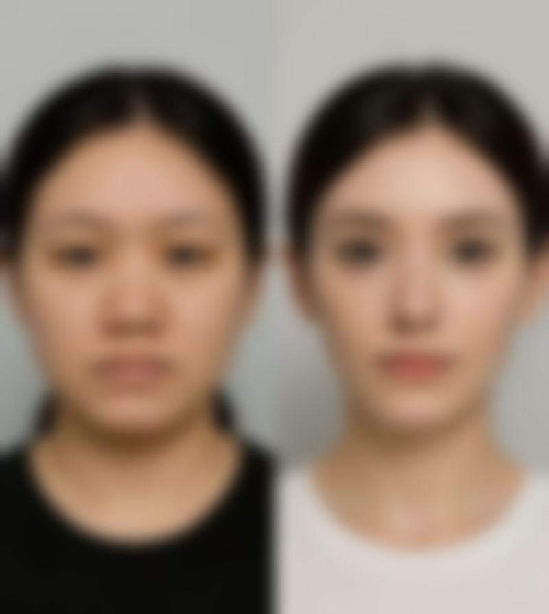 八、兰州军区陆 军总院整形美容中 心真实的顾客评价如下: