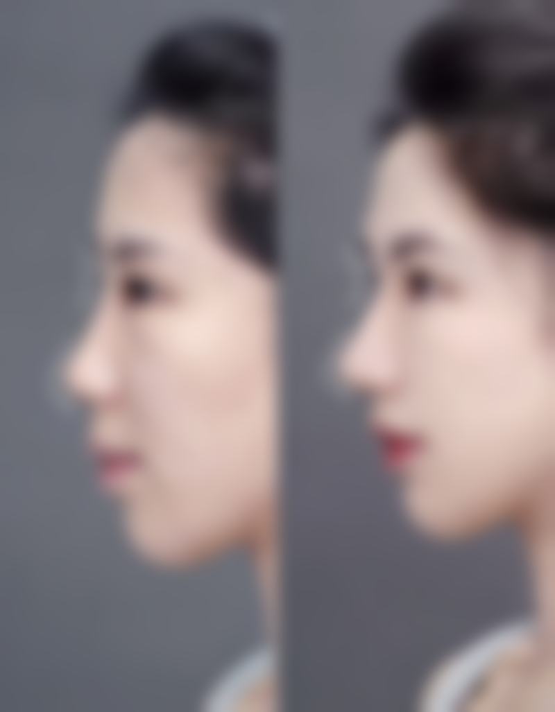 七、杭州聚美医疗美容有限公司价格表:(仅供参考)