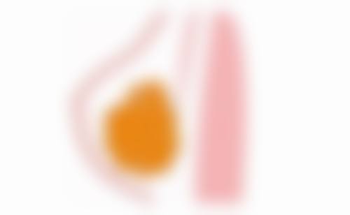 隆鼻修复阶段大揭秘:各阶段特点