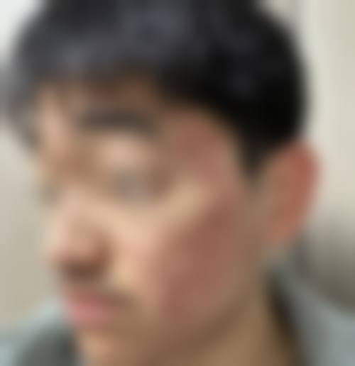 八、咸宁泉城医院皮肤美容科真实的顾客评价如下：