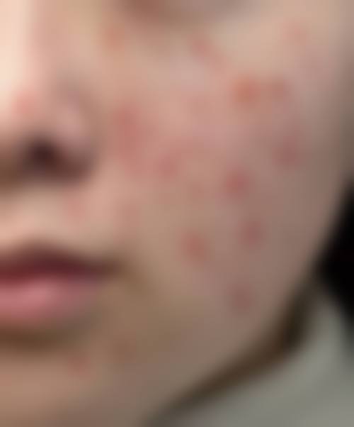 二、咸宁泉城医院皮肤美容科正规吗？来看看医院资质：