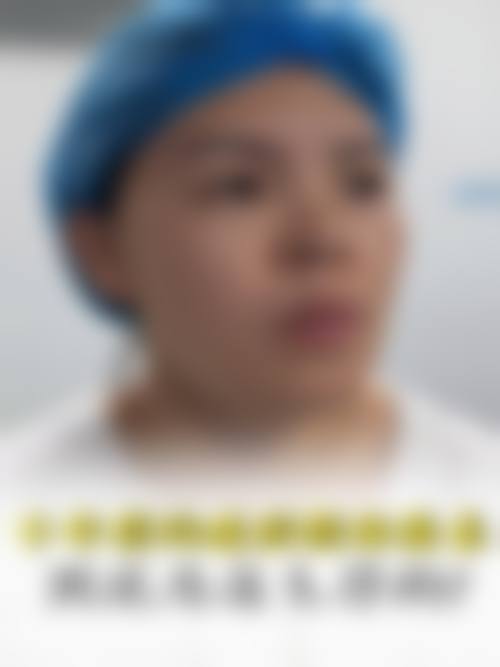 五、江门玛丽整形医院实例