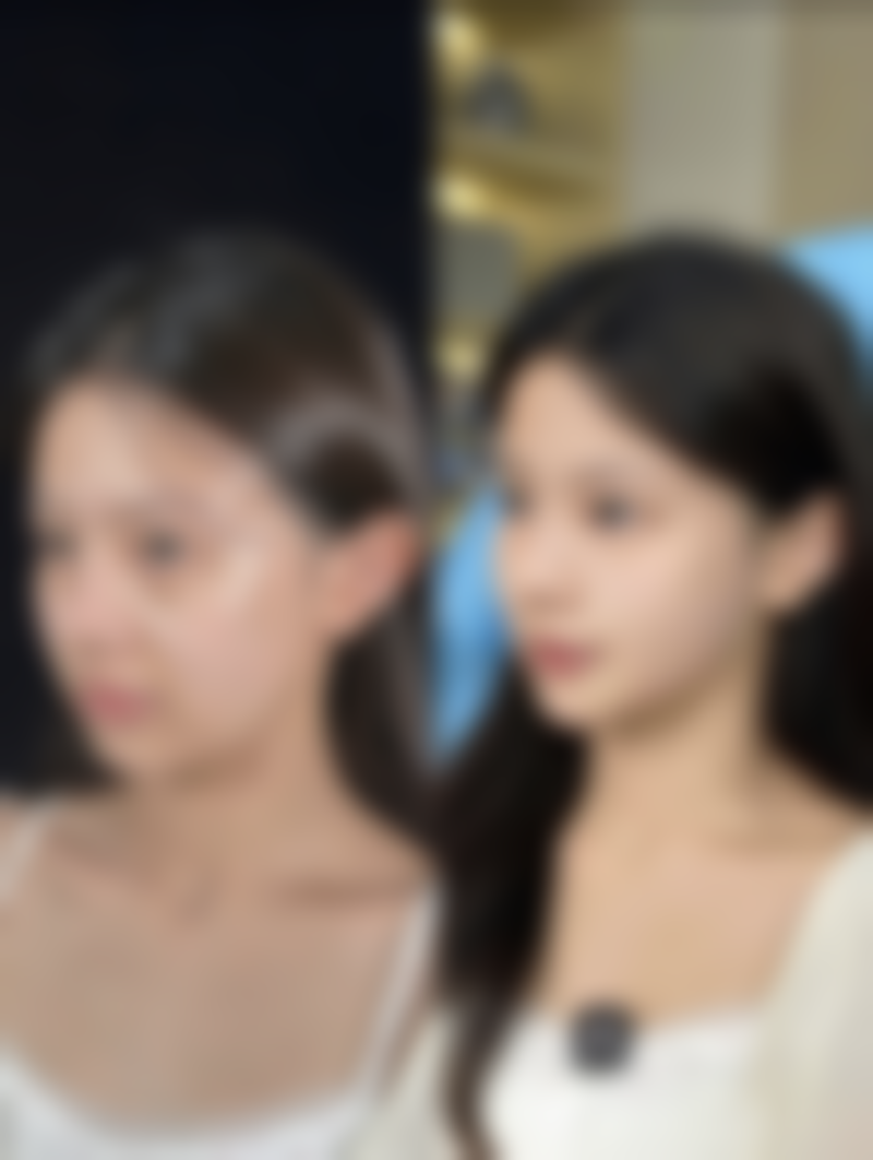 怎样巧妙消除缝针疤痕?光电/物理治疗有妙招