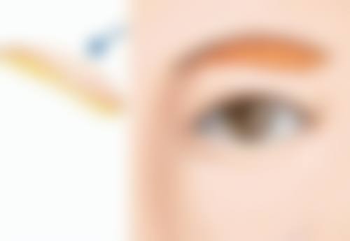 双下巴吸脂增生发生的特殊情况说明