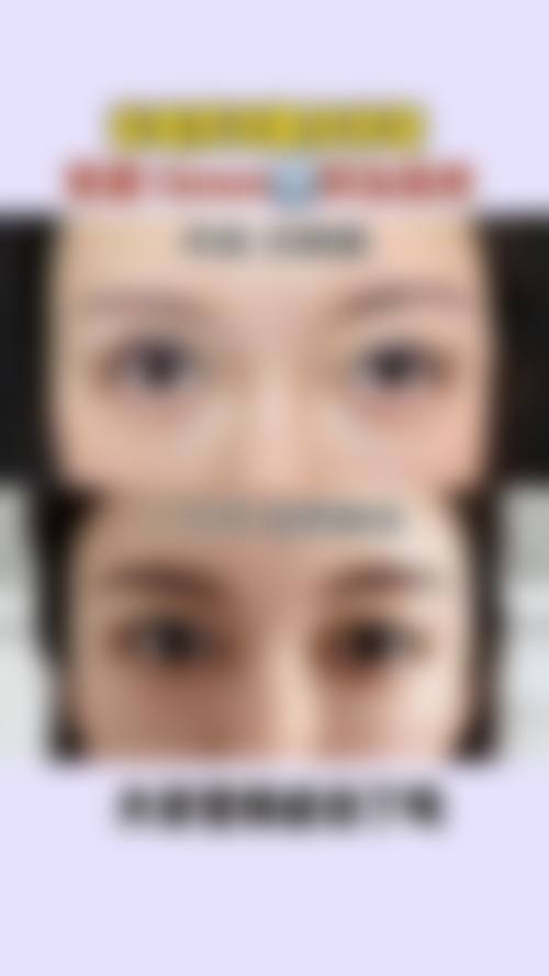 四、武汉立吉美润宜轩整形医院实例