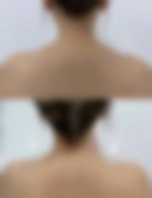 赵屹东医生实例