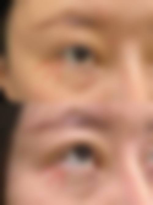 四、库尔勒瑞恩整形医院开展的主要项目和特色项目:
