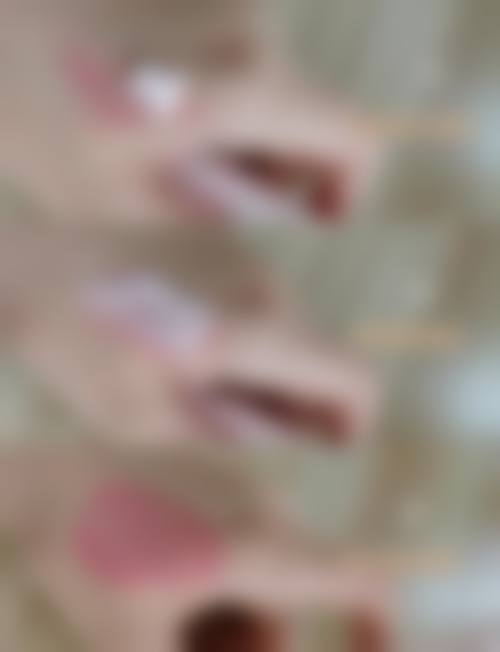 张绪生医生实例