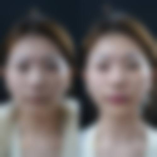 八、韩国KIES-U整形外科真实的顾客评价如下: