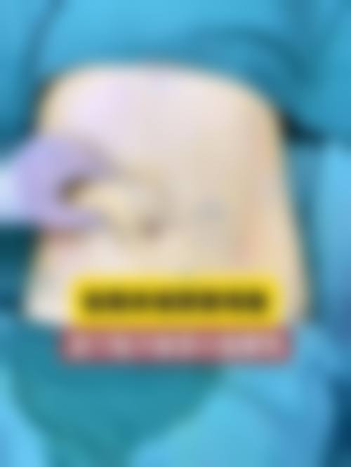 白承勋医生实例