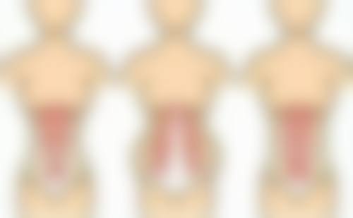 切眼袋手术会额外造成泪沟吗?