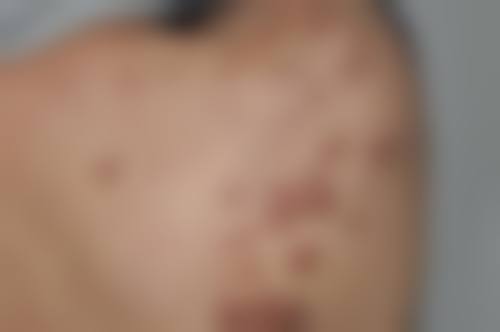 五、深圳雅星医疗美容门诊部怎么预约: