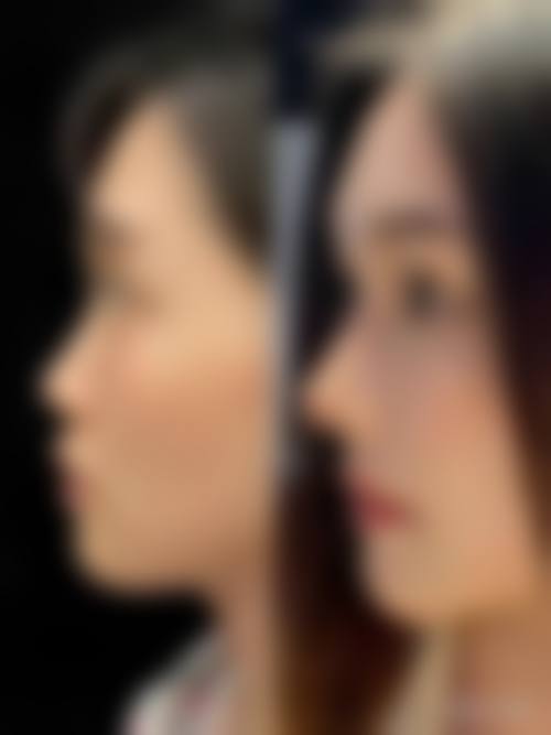 七、广州涵茜尚美医疗美容门诊部真实的顾客评价如下：