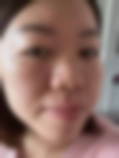 八、宁波宁海第一医院医疗美容科真实的顾客评价如下: