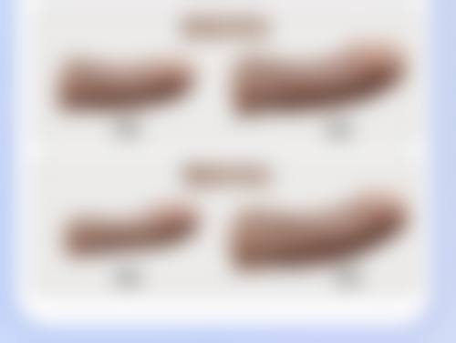 临床观点对假体隆胸安心性怎么看?