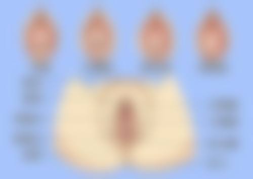 身体有手术疤痕参军:关键注意事项有哪些