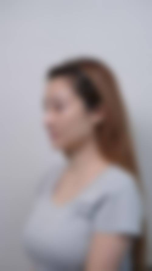 五、武平瑞妍整形医院实例