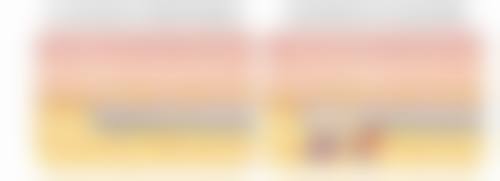 总结:腰腹抽脂暗藏伤害及防控要点