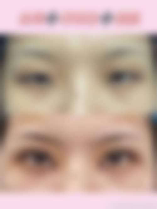 奚云清医生在哪家医院怎么预约?