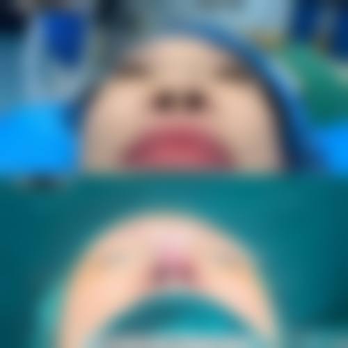 卢建伟医生实例