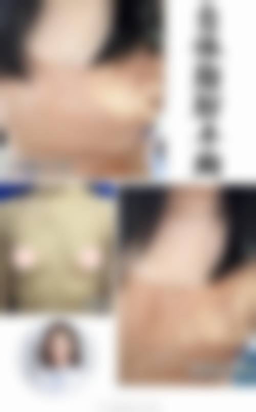 七、开原兰森整形医院价格表:(仅供参考)