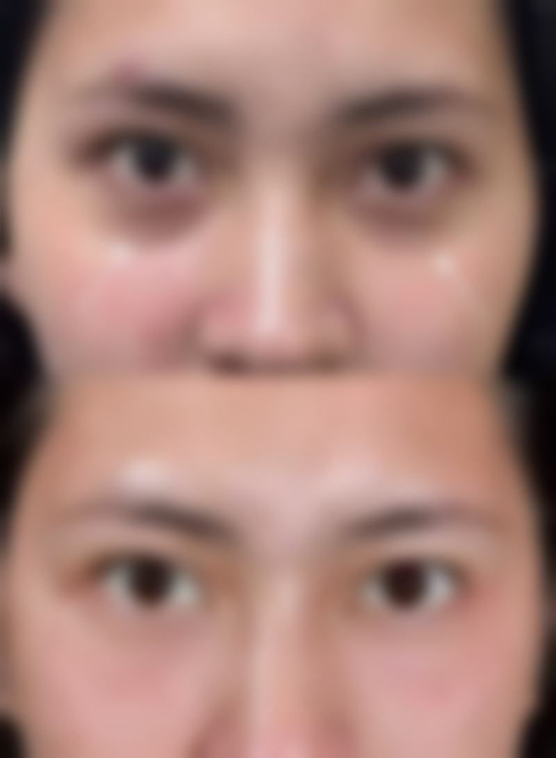 五、常州美贝尔医疗美容医院实例